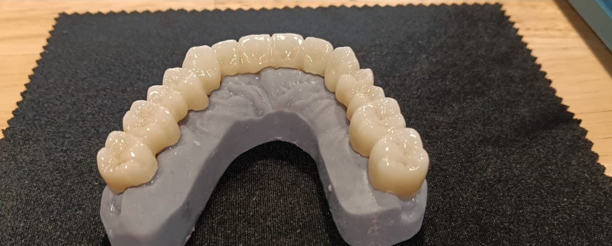 Ajuste sobre modelo impreso en 3D